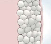 coolsculpting gold coast|CoolSculpting: Start treatment now for the body .